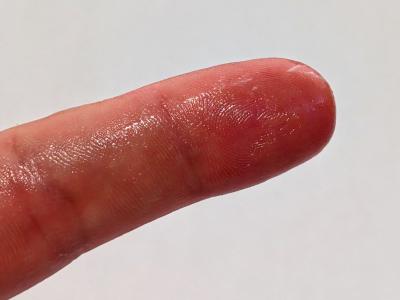 Coconut oil on a finger